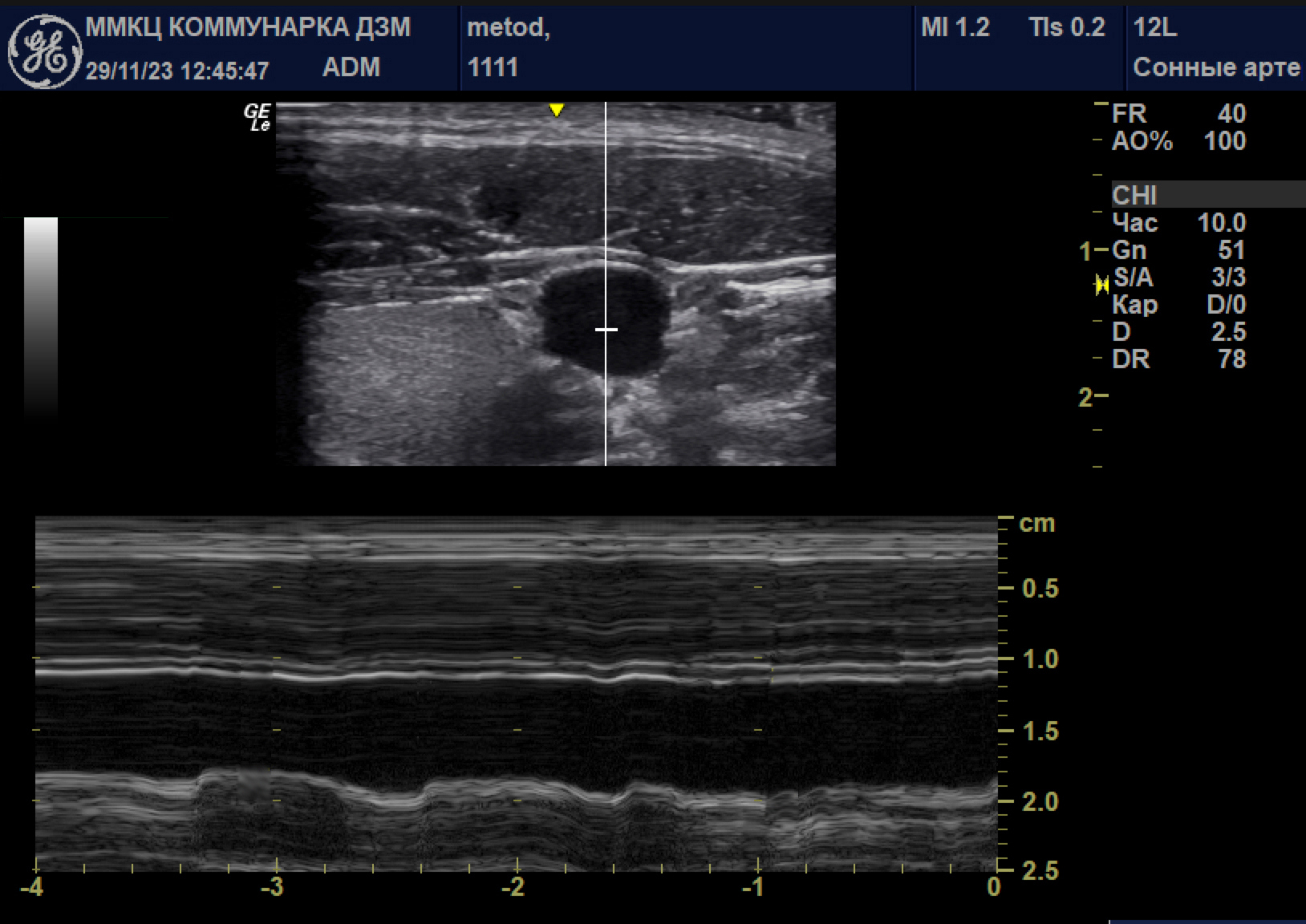 Шаг 6: Выставление метки М-режима